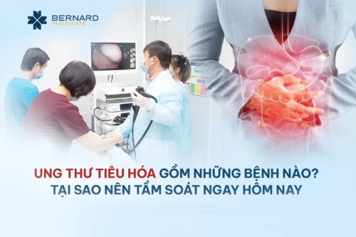 Ung thư tiêu hóa gồm những bệnh nào? Tại sao nên tầm soát ngay hôm nay